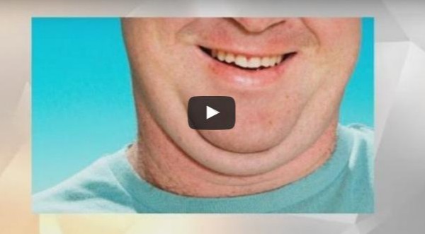 بالفيديو: حقنة لعلاج الذقن المزدوجة