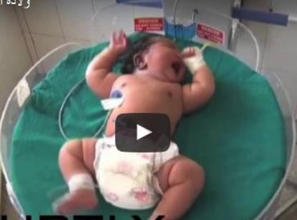 فيديو: ولادة أثقل طفلة في العالم بالهند