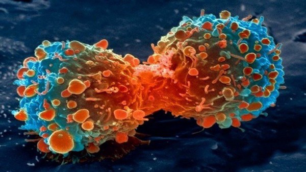 اكتشاف طريقة جديدة لقتل الخلايا السرطانية