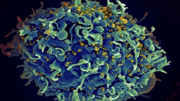 "حمض الريتينويك" هو المنقد من فيروس نقص المناعة البشرية