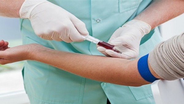 اختبار للدم للتنبؤ بخطر الإصابة بأزمة قلبية خلال 5 سنوات