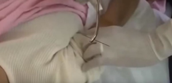 فتاة مسحورة يخرج من جسدها إبراً حديدية