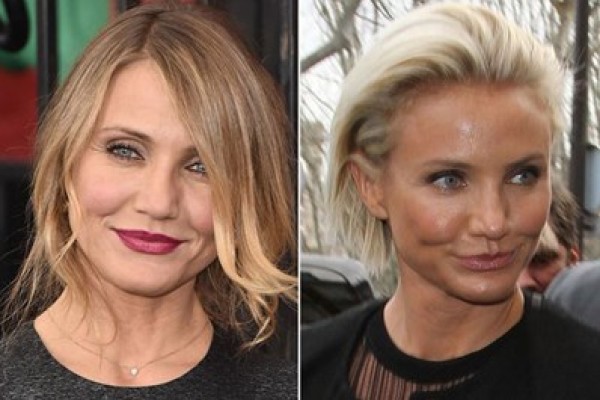 بالصور شاهد كيف تغير شكل النجمات بعد التخلص من البوتوكس