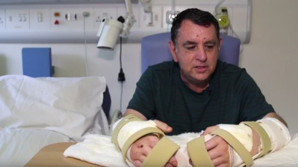 بالفيديو : أول شخص يحصل على يدين مزروعتين في المملكة المتحدة