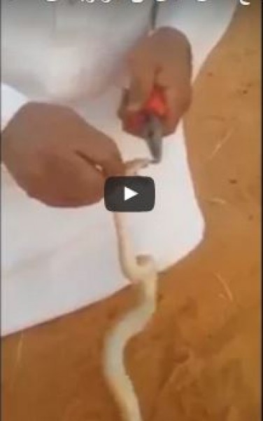 سعودي يقتلع أسنان ثعبان