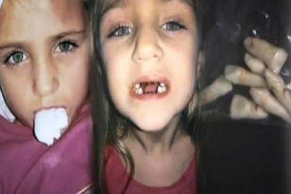 فيديو: صوّرت ابنتها خفية عند طبيب الأسنان.. وما فعله بالصغيرة كابوس حقيقي