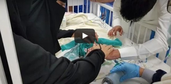 لحظة رؤية والدي التوأم السيامي السعودي بعد فصلهما