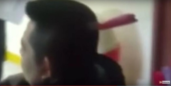 رجل يخيف الأطباء بسكين مغروز في رأسه