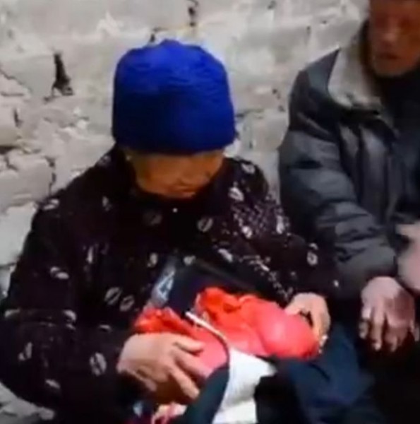 بالفيديو: صينية تحمل أمعاءها في كيس من البلاستيك منذ 20 عاماً