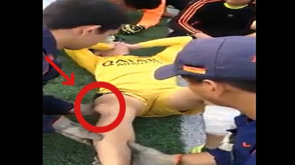 أطباء يعالجون ركبة لاعب كرة قدم تعرضت للخلع