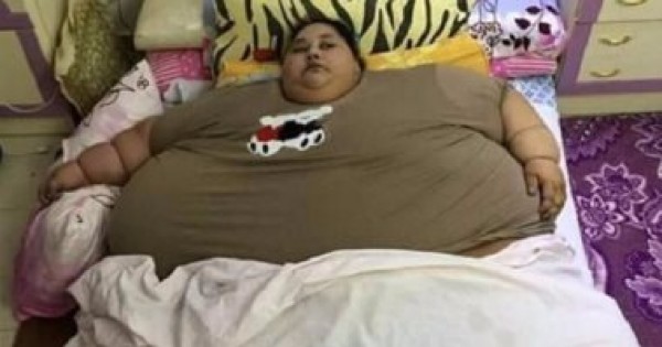 طبيب أسمن امرأة مصرية يُفجر سلسلة من المفاجآت..وزنها ليس500 كجم!