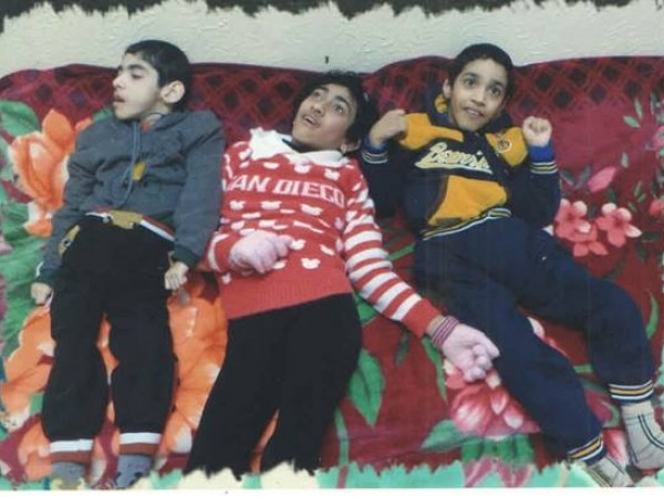 ثلاثة أطفال "شلل دماغي" يناشدون الرئيس محمود عباس