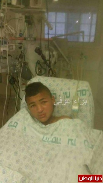 الصحة:تحويل الفتى عوفي والمصاب بلدغة أفعى فلسطين إلى مشافي إسرائيل