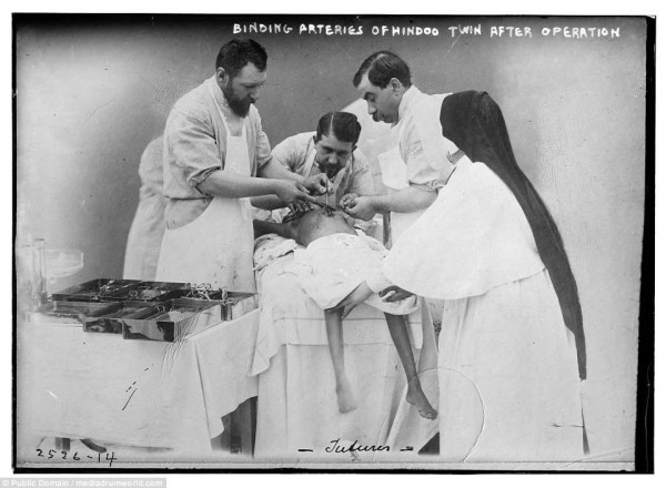 شاهد كيف كانت تجرى العمليات الجراحية قبل 100 عام