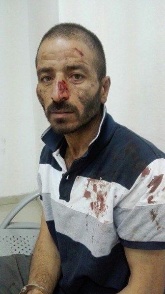 هيئة الأسرى: شرطة الاحتلال تعتدي بالضرب المبرح على "ياسر هدره"