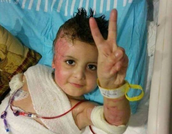 دوابشة يرد على تصريحات يعالون..ويكشف لدنيا الوطن ظروف"أحمد" بعد مرور 3 سنوات