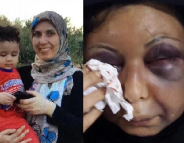 جريمة تهز البحرين: تعذيب وتشويه سورية!