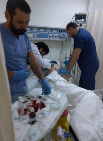 محاولة اغتيال فنان سوري طعناً في صدره في تركيا والسبب مُروع