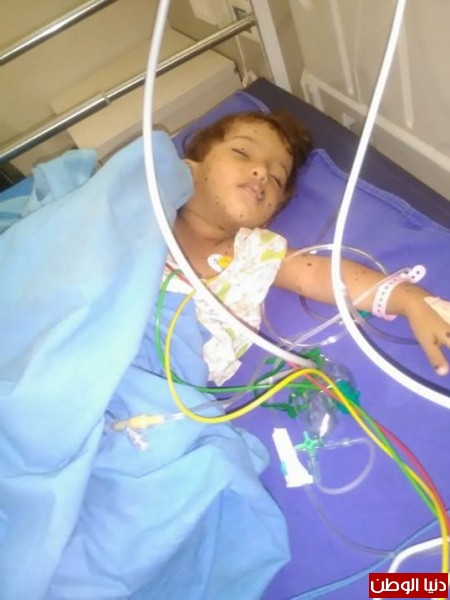 الطفلة رنيم تعاني من ورم سرطاني و تحتاج للسفر للهند