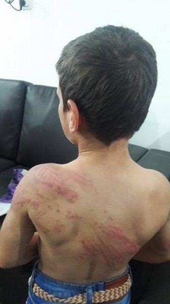 غزة: الطفل المُعنّف يكشفُ تفاصيل قاسية .. والشُرطة: "صُعقنا مما شاهدنا وندعو لتوعية المجتمع"