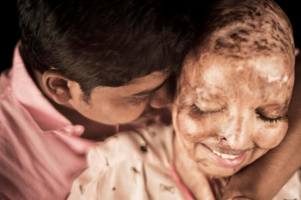 مستشفى في الهند تشهد أغرب قصة حب داخل أسوارها
