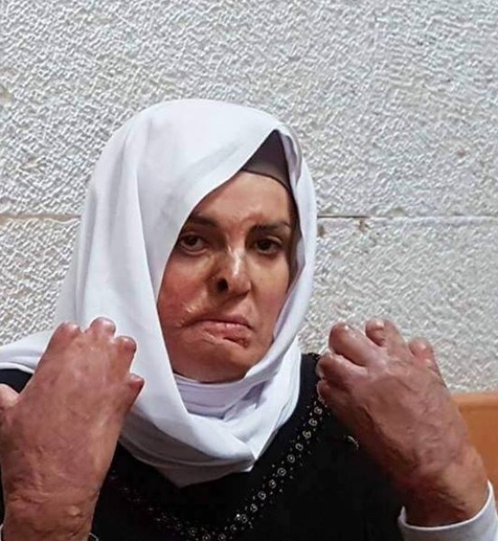"فش أصابع"..أحدث ظهور للأسيرة إسراء الجعابيص يُبكي الآلاف بسبب ما كشفته