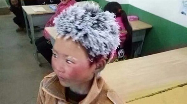 صورة مؤلمة جداً لطفل صيني جمعت تبرعات ب336 ألف دولار