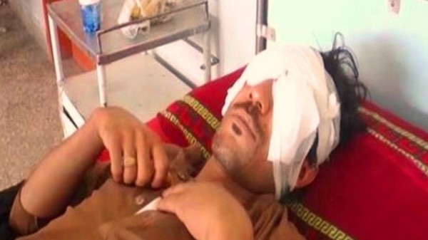 باكستان: اقتلع والده عينيه لسبب لا يصدق