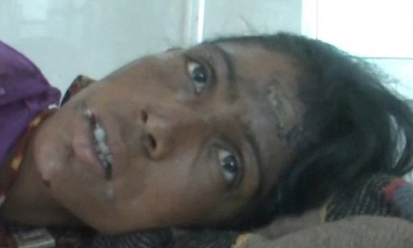 مشهد مروع لما فعله طبيب مشعوذ بامرأة هندية