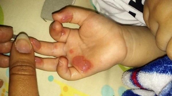 الشرطة الإماراتية تطارد أما متهمة بـ "حرق" طفلها الصغير