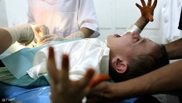 بتر العضو الذكري لطفل مصري أثناء عملية "الطهور"