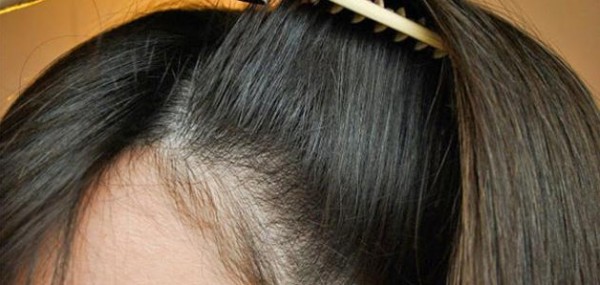 10 أسباب تؤدي إلى الشعر الخفيف لدى النساء