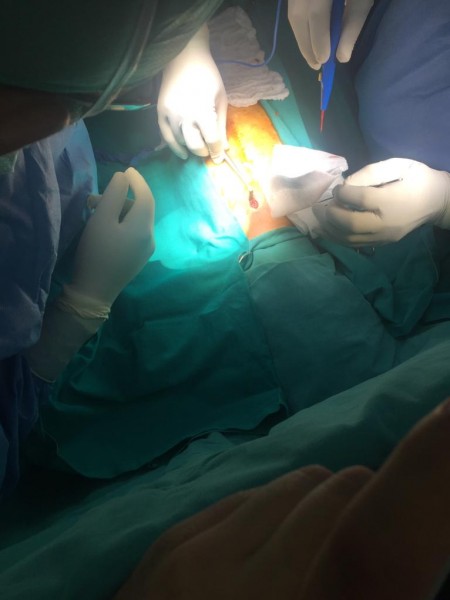 فريق جراحي القلب والعمليات بمستشفى النجاح الجامعي بنابلس ينقذ حياة طفل