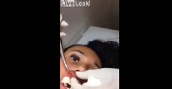 لقطات صادمة للحظة استخراج دودة عملاقة من شفاه فتاة لقطات صادمة للحظة استخراج دودة عملاقة من شفاه فتاة