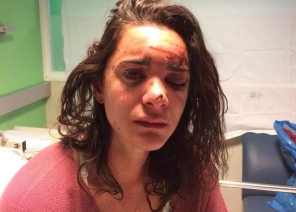 أمريكية تروي واقعة اغتصابها في محطة أتوبيس: "تظاهرت بالموت ليتركني"