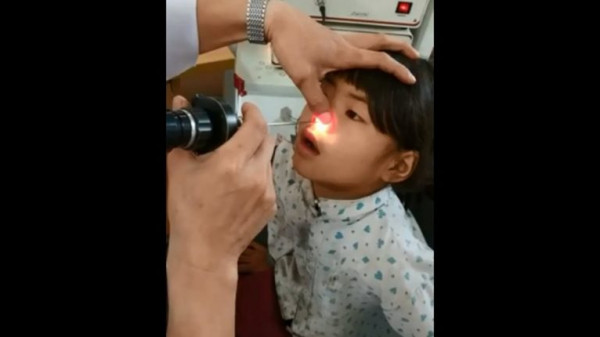 بعد تورم وجهها.. ما عثر عليه طبيب داخل أنف طفلة غير متوقع