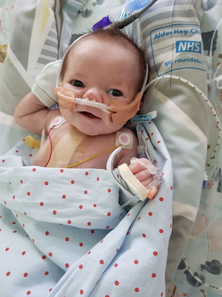 "الرضيع المعجزة" نجا من 25 نوبة قلبية في يوم واحد