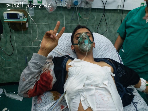 أربع إصابات برصاص الاحتلال خلال فعاليات الإرباك الليلي شرقي رفح