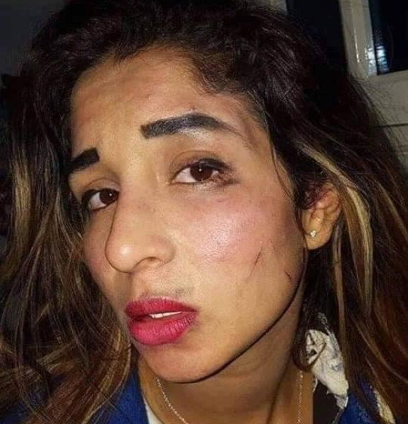 مُروع.. ماتتعرض له هذه السيدة يستنفر السلطات التونسية