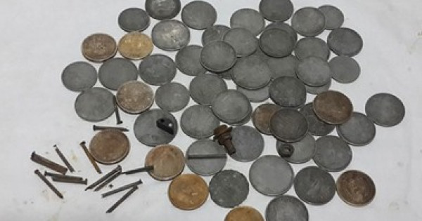أطباء يستخرجون 38 قطعة معدنية من معدة رجل هندي