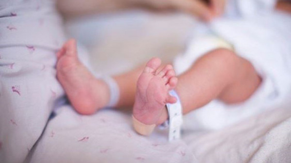 ولادة طفلة "حامل" بجنين في ظاهرة نادرة الحدوث