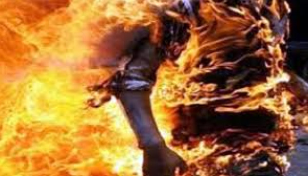 بدم بارد.. امرأة تحرق زوجها حيا بسبب لون بشرته