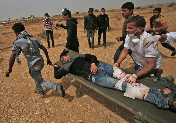 1700 مصاب مهددون ببتر أطرافهم في قطاع غزة