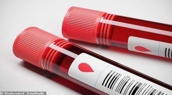 اختبار دم جديد يتنبأ بالوفاة خلال 10 أعوام