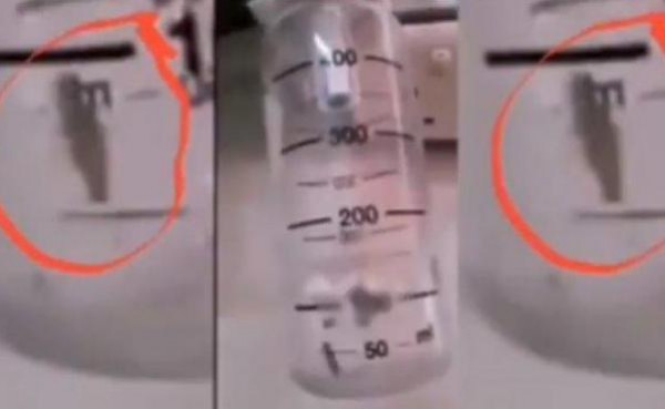 "صرصور" داخل جهاز تنفس بمستشفى حكومي بالأردن.. ونشطاء: يُعطي طعم خاص للتبخيرة