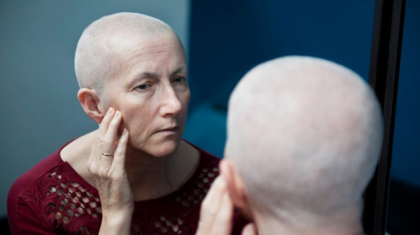 ابتكار عقار يحمي مرضى السرطان من تساقط الشعر أثناء العلاج بالكيماوي