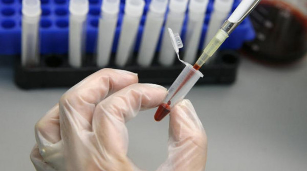انفجار في مختبر روسي يحتوي على فيروسات الجدري والإيبولا والإيدز