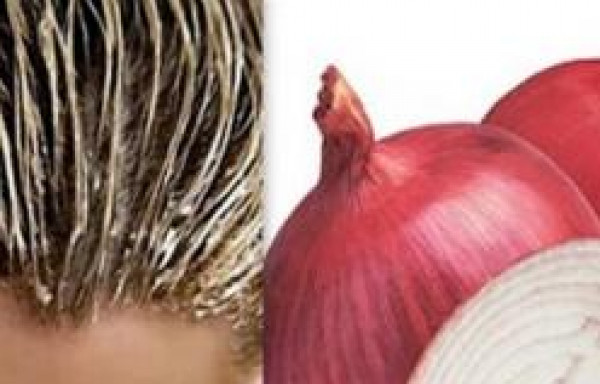 وصفة البصل السحرية لعلاج تساقط الشعر