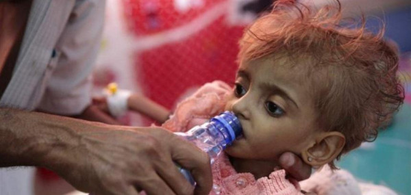 الصحة العالمية: وفاة 257 يمنيا بوباء الدفتيريا خلال نحو عامين