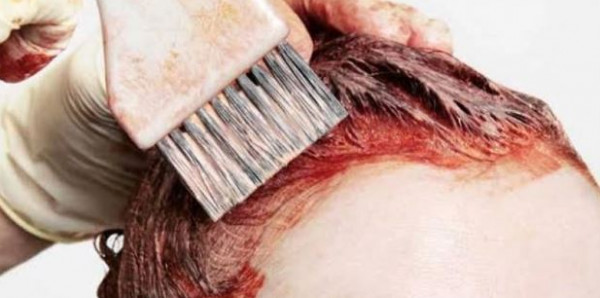 فتاة تستخدم كيسا بلاستيكيا في صبغة الشعر.. والنتيجة كارثية